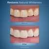 image:imageWaterpik Fresh Mint Whitening Refill Tablets 30 Count Restore Natural Teeth Whiteness Packaging May Vary WT30White