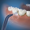 image:imageWaterpik Handheld Water Flosser LowFlow Replacement Tips 2 Count JT360E  Genuine Waterpik Brand Precision Refill Nozzles Heads for Every Day Gum Health Blue Replace Every 6 Months2 Count Pack of 1
