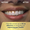 image:imageWaterpik Aquarius Countertop Water Flosser with 10 Settings 7 Tips Blue  For Daily Home Gum Health Dental Braces Implants Teeth Cleaning Multiple Users ADA Accepted WP663 Packaging May VaryBlue