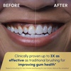 image:imageWaterpik Sensonic Complete Care Water Flosser amp Electric Toothbrush Combo