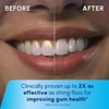 image:imageWaterpik Cordless Pulse 3100 Portable Water Flosser Rechargeable CyanBlue