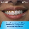 image:imageWaterpik Cordless Pulse 3100 Portable Water Flosser Rechargeable CyanCyan